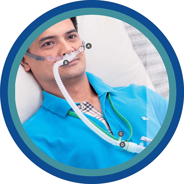 High Flow Nasal Cannula Manufacturers in Delhi, Nasal Oxygen Cannula ...